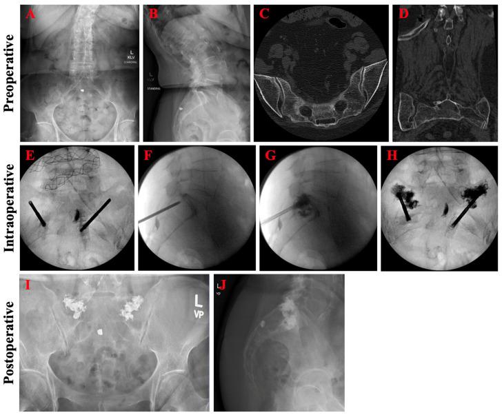 https://cdn.ncbi.nlm.nih.gov/pmc/blobs/fdd2/10889545/381dce2f7636/jcm-13-01101-g005.jpg