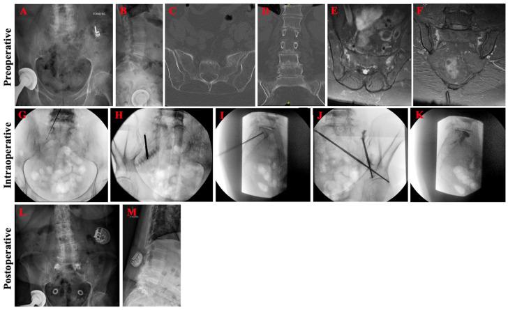 https://cdn.ncbi.nlm.nih.gov/pmc/blobs/fdd2/10889545/65c98e7861ab/jcm-13-01101-g004.jpg