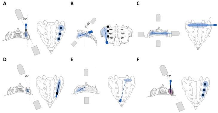 https://cdn.ncbi.nlm.nih.gov/pmc/blobs/fdd2/10889545/824ab008054f/jcm-13-01101-g003.jpg