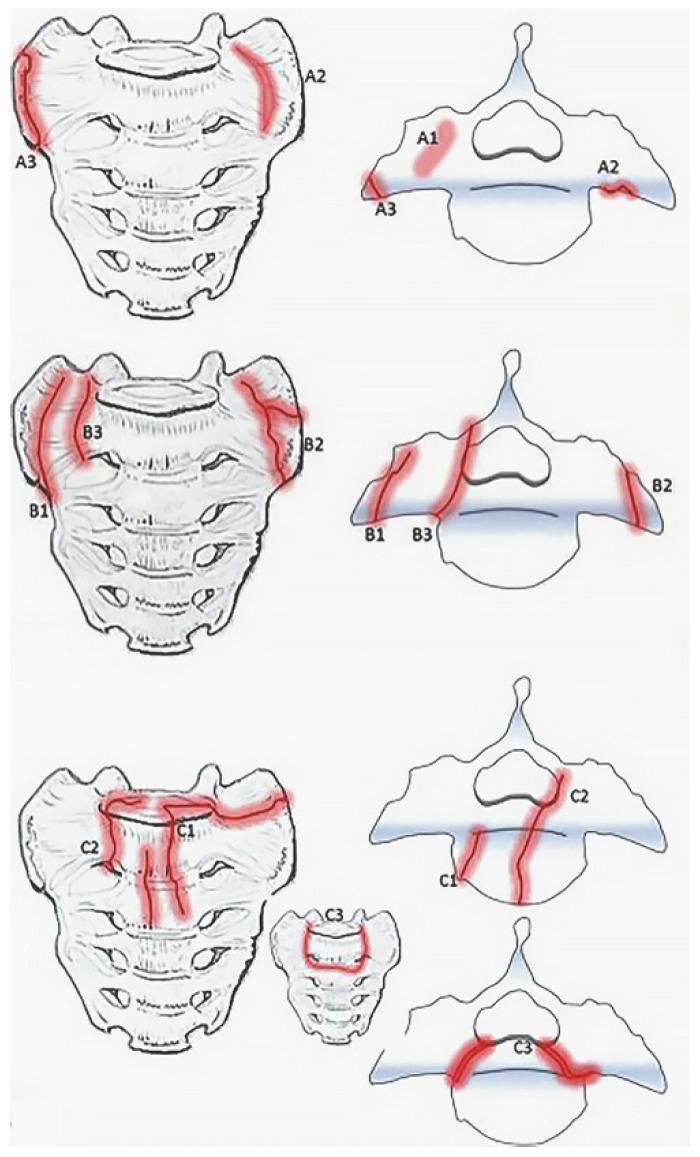 https://cdn.ncbi.nlm.nih.gov/pmc/blobs/fdd2/10889545/b622e3b219aa/jcm-13-01101-g002.jpg