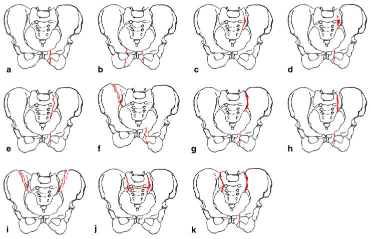 https://cdn.ncbi.nlm.nih.gov/pmc/blobs/fdd2/10889545/f6b44e29d122/jcm-13-01101-g001.jpg