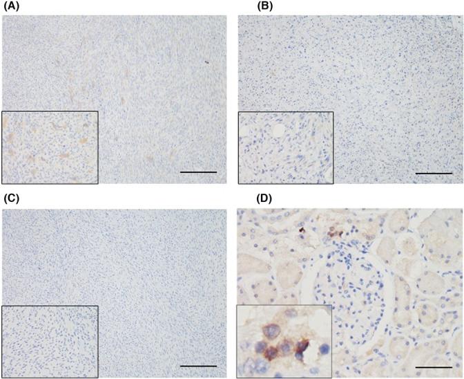 https://cdn.ncbi.nlm.nih.gov/pmc/blobs/fdd7/10399534/345aeaf42228/JCMM-27-2183-g006.jpg