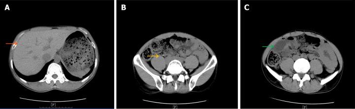 https://cdn.ncbi.nlm.nih.gov/pmc/blobs/fdda/11235555/c5635c15648b/WJCC-12-4391-g001.jpg