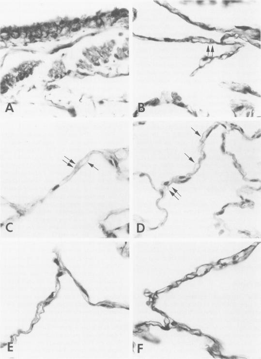 https://cdn.ncbi.nlm.nih.gov/pmc/blobs/fdda/1865188/320591173cc3/amjpathol00034-0163-a.jpg