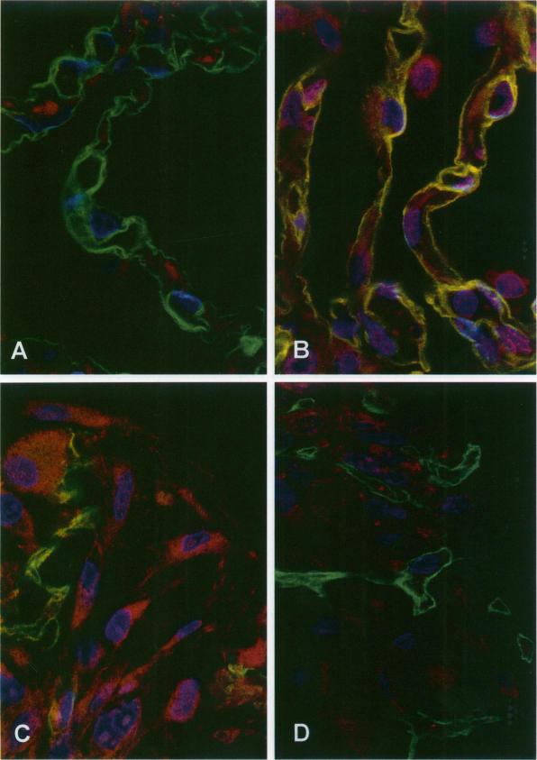 https://cdn.ncbi.nlm.nih.gov/pmc/blobs/fdda/1865188/c90dc1a23eb3/amjpathol00034-0169-a.jpg