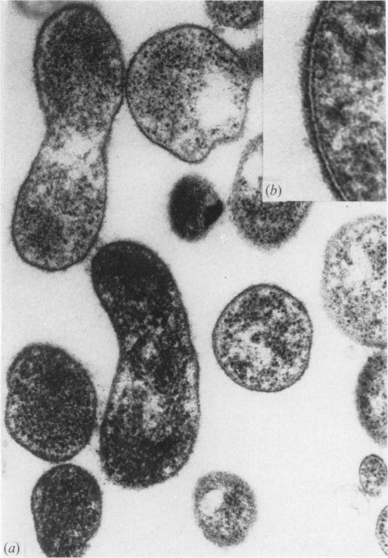 https://cdn.ncbi.nlm.nih.gov/pmc/blobs/fdda/2130589/0721650049cc/jhyg00072-0112-a.jpg
