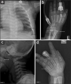 https://cdn.ncbi.nlm.nih.gov/pmc/blobs/fddc/5341272/9308a9ae0381/AIAN-20-62-g005.jpg