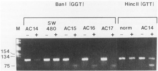 https://cdn.ncbi.nlm.nih.gov/pmc/blobs/fde0/1887193/9e7663496706/amjpathol00069-0053-a.jpg