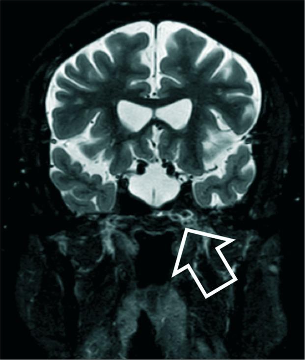 https://cdn.ncbi.nlm.nih.gov/pmc/blobs/fde7/7110400/365ba7de919e/SNI-11-48-g001.jpg