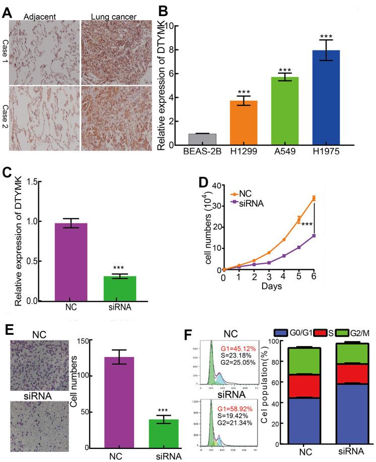 https://cdn.ncbi.nlm.nih.gov/pmc/blobs/fde7/9596207/20b4ee077863/aging-14-204308-g009.jpg