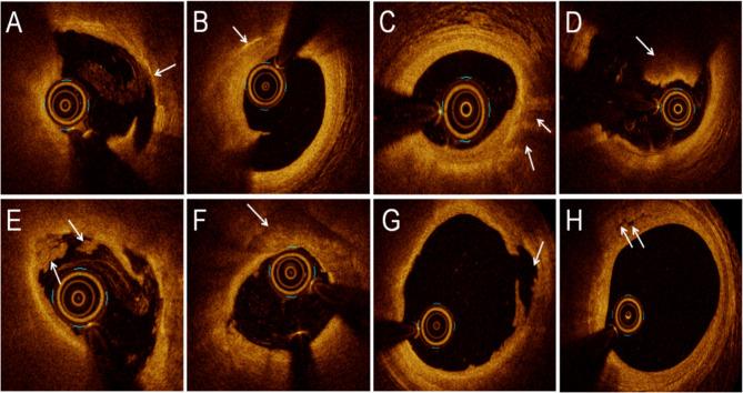 https://cdn.ncbi.nlm.nih.gov/pmc/blobs/fded/12317499/26636b39d13c/12872_2025_4995_Fig1_HTML.jpg