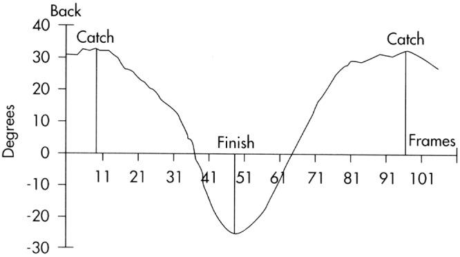 https://cdn.ncbi.nlm.nih.gov/pmc/blobs/fdee/3435926/0b60a12e97a3/10.1177_1941738112442484-fig3.jpg