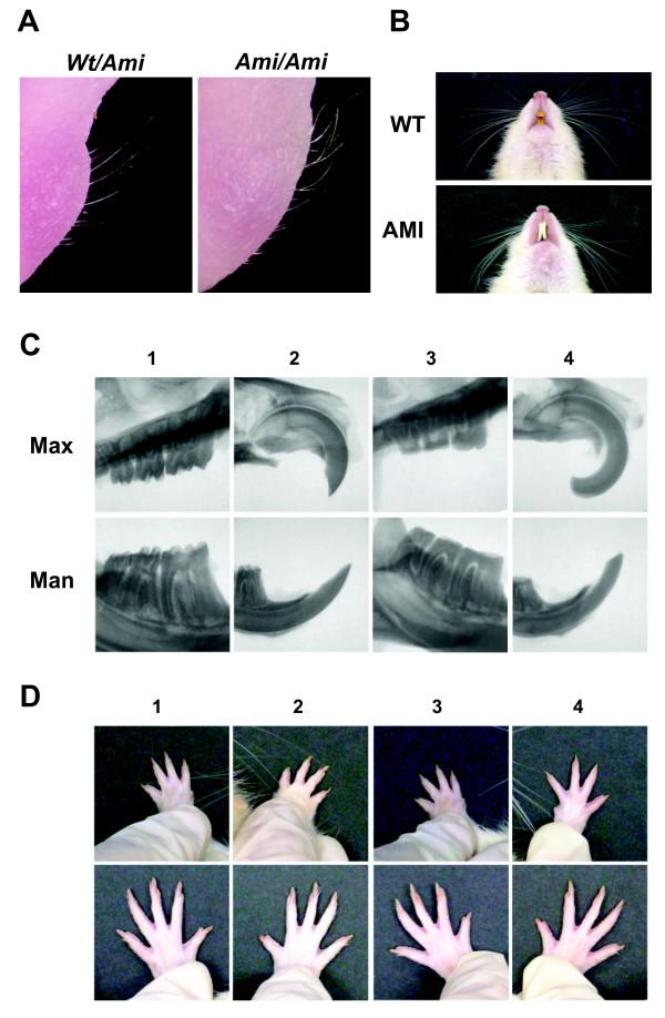 https://cdn.ncbi.nlm.nih.gov/pmc/blobs/fdf0/3464675/7b993dfbc659/1750-1172-7-34-4.jpg