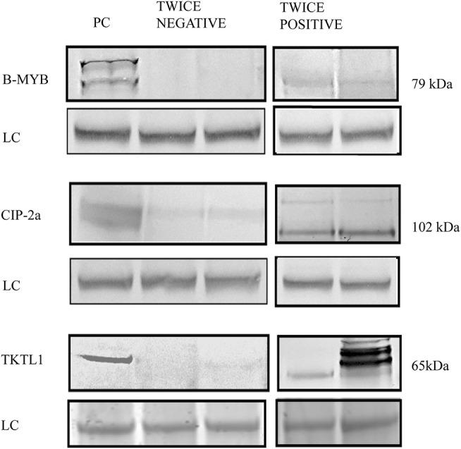 https://cdn.ncbi.nlm.nih.gov/pmc/blobs/fdf7/6456695/1a551f0c39cb/fonc-09-00213-g0001.jpg