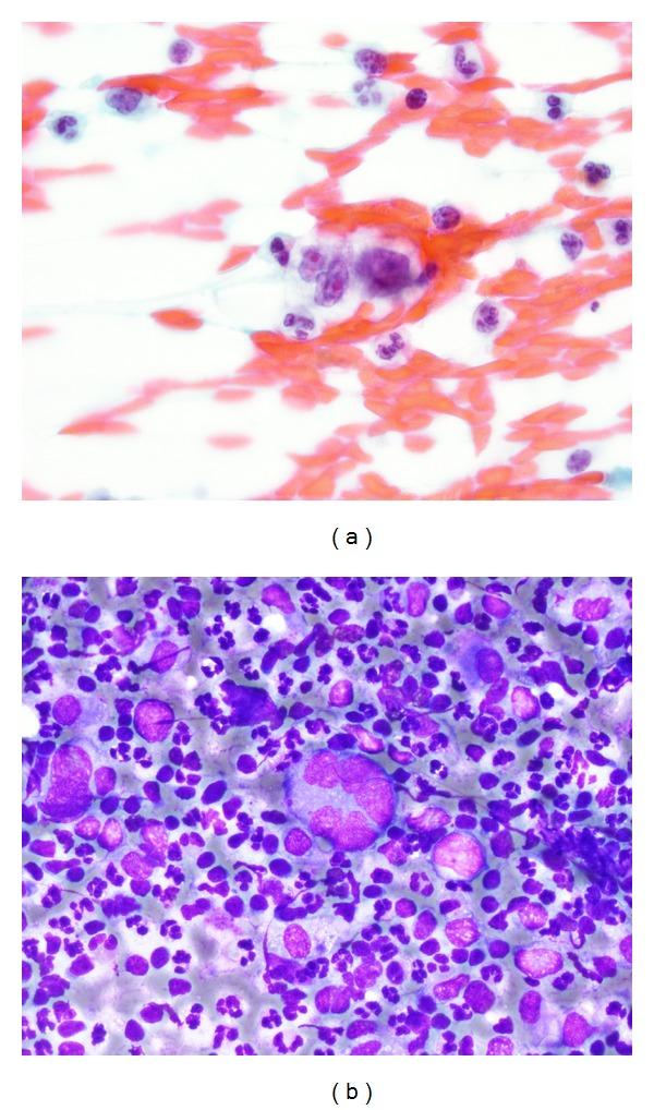 https://cdn.ncbi.nlm.nih.gov/pmc/blobs/fdfc/4053181/a1a85b917e00/CRIHEM2014-642868.001.jpg
