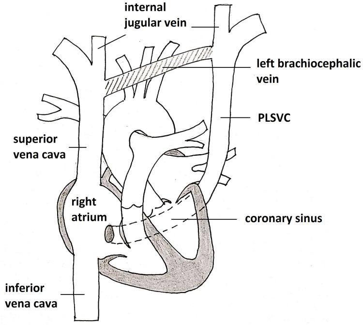 https://cdn.ncbi.nlm.nih.gov/pmc/blobs/fe06/7534844/63b84f9f8a4e/IMCRJ-13-465-g0003.jpg