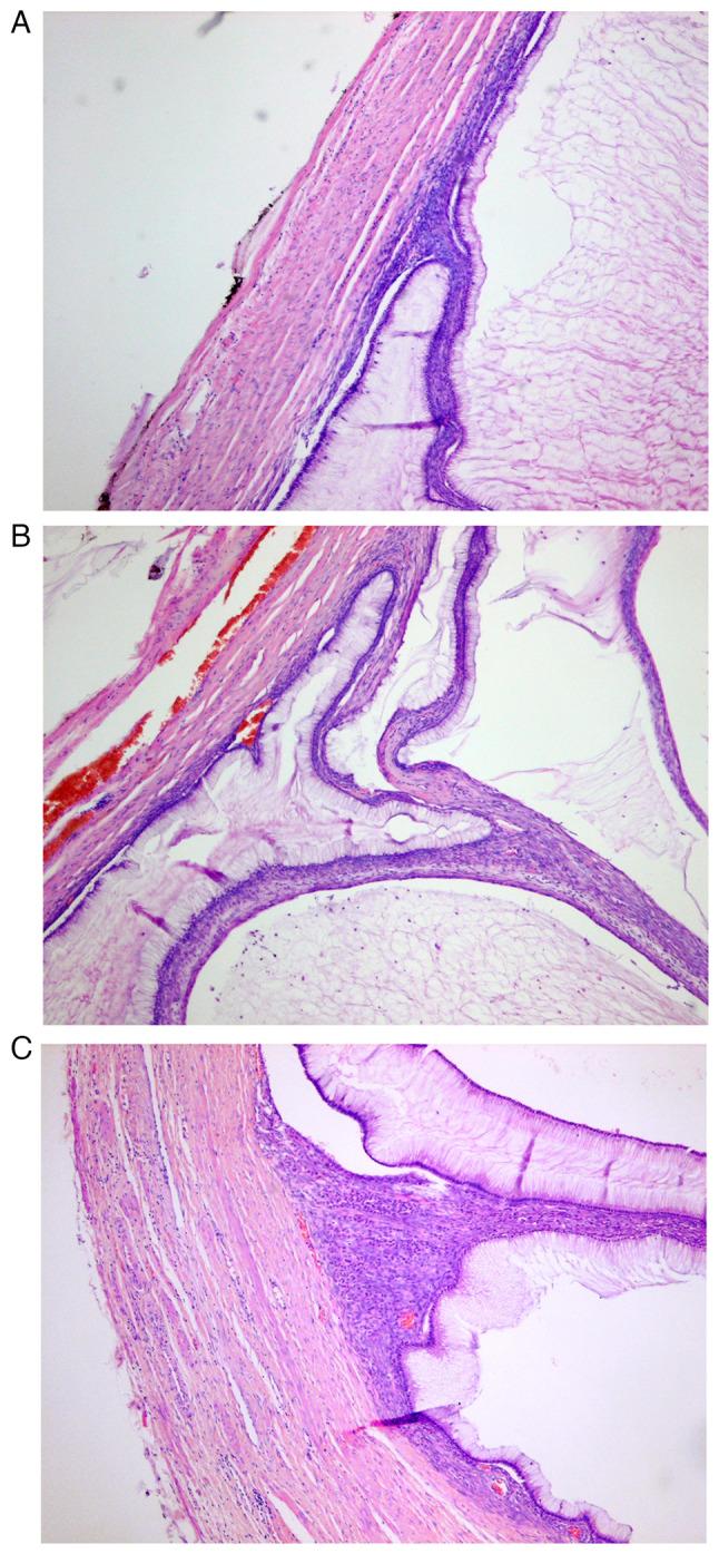 https://cdn.ncbi.nlm.nih.gov/pmc/blobs/fe10/11369849/9d2b828f3e16/ol-28-05-14633-g02.jpg
