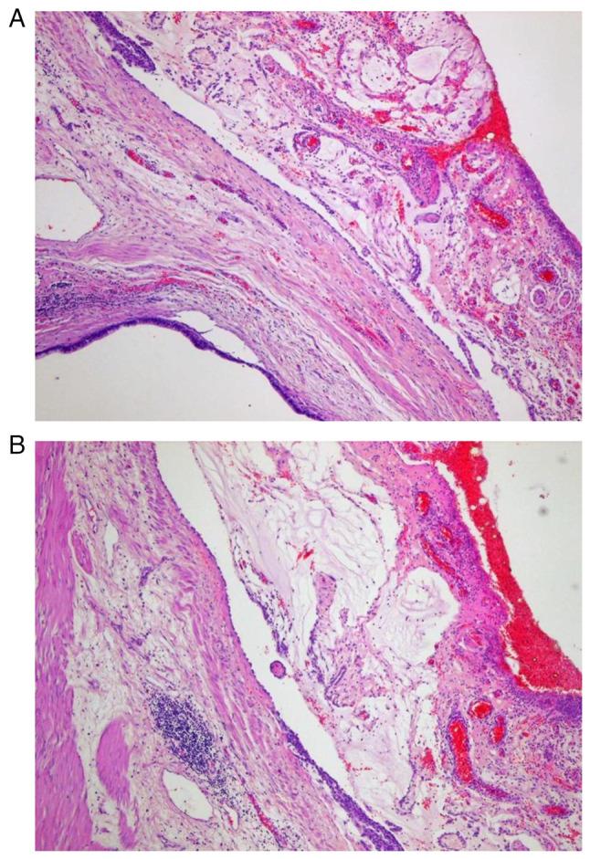 https://cdn.ncbi.nlm.nih.gov/pmc/blobs/fe10/11369849/fd98316663f4/ol-28-05-14633-g01.jpg