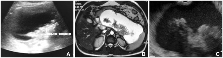 https://cdn.ncbi.nlm.nih.gov/pmc/blobs/fe15/4760061/ba07e2b58242/gou088f1p.jpg