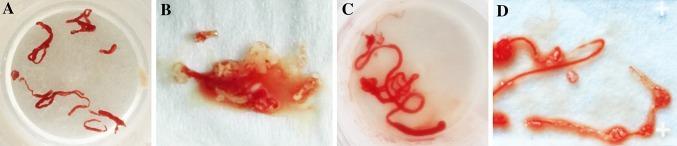 https://cdn.ncbi.nlm.nih.gov/pmc/blobs/fe2a/6061052/9d9c62455432/464_2018_6075_Fig2_HTML.jpg
