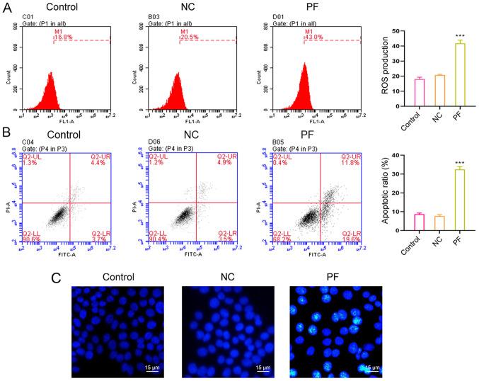 https://cdn.ncbi.nlm.nih.gov/pmc/blobs/fe31/8652401/3ea46f83f38c/etm-23-01-10975-g02.jpg