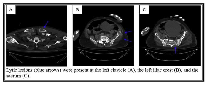 https://cdn.ncbi.nlm.nih.gov/pmc/blobs/fe37/9195103/d62beaad941a/jchimp-12-01-083f1.jpg