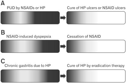 https://cdn.ncbi.nlm.nih.gov/pmc/blobs/fe3b/3228976/44b97e4e51b2/jnm-17-366-g002.jpg