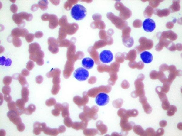 https://cdn.ncbi.nlm.nih.gov/pmc/blobs/fe3b/6213823/28f1876dfd82/amjcaserep-19-1262-g001.jpg