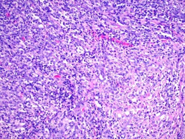 https://cdn.ncbi.nlm.nih.gov/pmc/blobs/fe3b/6213823/54dead8b47b2/amjcaserep-19-1262-g004.jpg