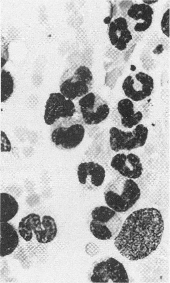 https://cdn.ncbi.nlm.nih.gov/pmc/blobs/fe43/1235941/b27d0f469d29/compmed00011-0056-b.jpg