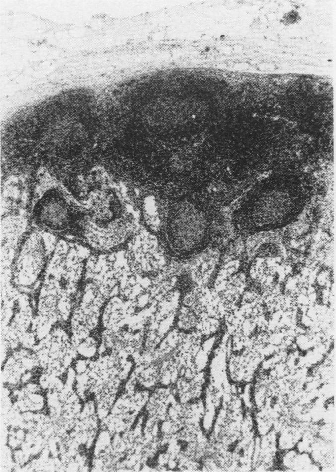 https://cdn.ncbi.nlm.nih.gov/pmc/blobs/fe43/1235941/c9d3921b15c2/compmed00011-0057-a.jpg