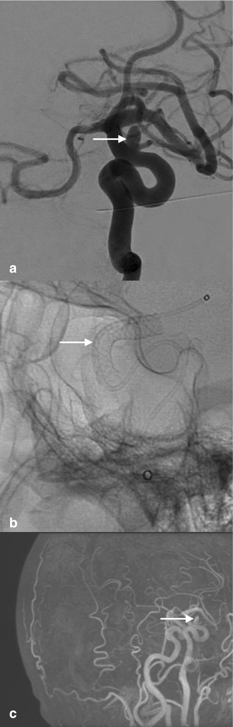 https://cdn.ncbi.nlm.nih.gov/pmc/blobs/fe48/10230224/5e394747015c/bjrcr.20220136.g001.jpg