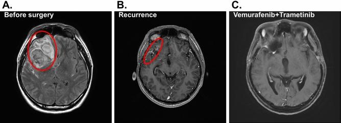 https://cdn.ncbi.nlm.nih.gov/pmc/blobs/fe4b/9525286/08a8da5dd622/41598_2022_20487_Fig2_HTML.jpg