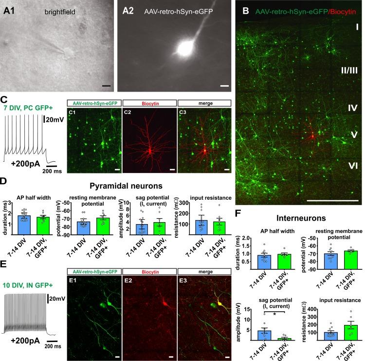 https://cdn.ncbi.nlm.nih.gov/pmc/blobs/fe4c/6733599/6a20e2c7ddd3/elife-48417-fig8.jpg