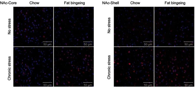 https://cdn.ncbi.nlm.nih.gov/pmc/blobs/fe4d/6512647/ca8d2acb270b/NDT-15-1211-g0013.jpg