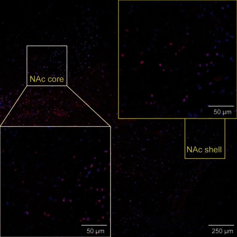 https://cdn.ncbi.nlm.nih.gov/pmc/blobs/fe4d/6512647/dcb89c16047f/NDT_A_204818_O_SF0001g.jpg