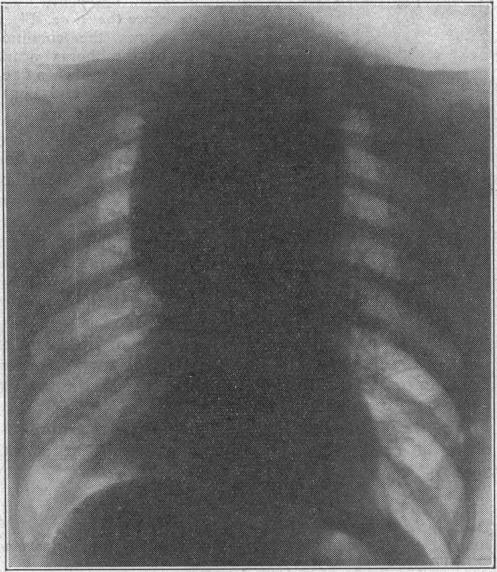 https://cdn.ncbi.nlm.nih.gov/pmc/blobs/fe4f/2037184/4295bbb3b863/brmedj03590-0007-b.jpg