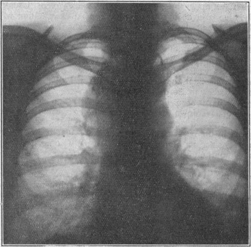 https://cdn.ncbi.nlm.nih.gov/pmc/blobs/fe4f/2037184/d3672cda422e/brmedj03590-0006-a.jpg