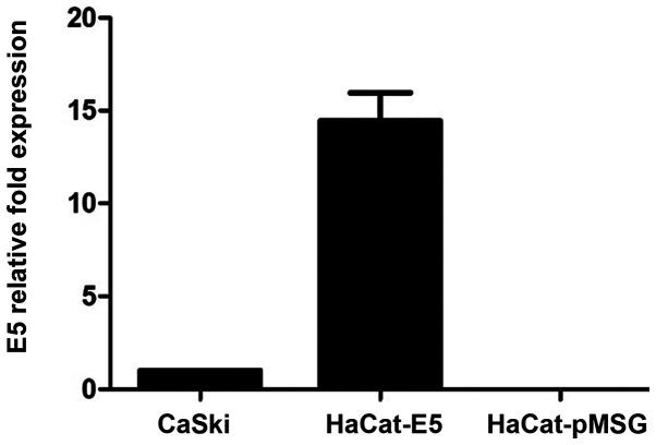 https://cdn.ncbi.nlm.nih.gov/pmc/blobs/fe50/7647045/369f1e809238/MMR-22-06-5444-g00.jpg