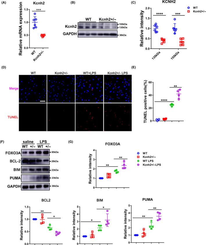 https://cdn.ncbi.nlm.nih.gov/pmc/blobs/fe50/7848965/f8e2ac24e3a7/CPR-54-e12962-g004.jpg
