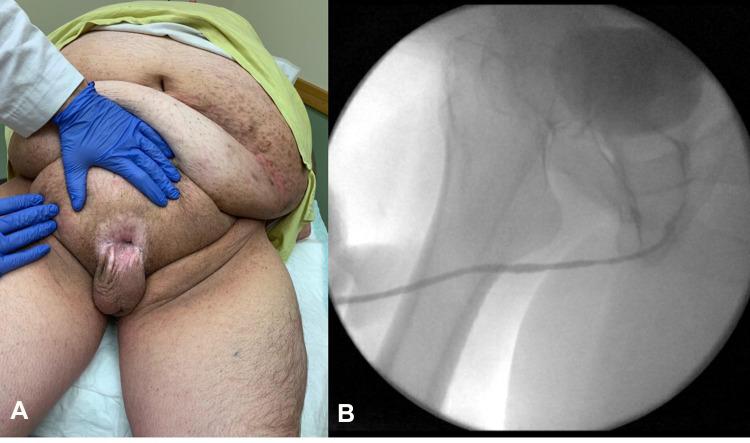 https://cdn.ncbi.nlm.nih.gov/pmc/blobs/fe52/8128502/b49e0611b568/RRU-13-237-g0003.jpg