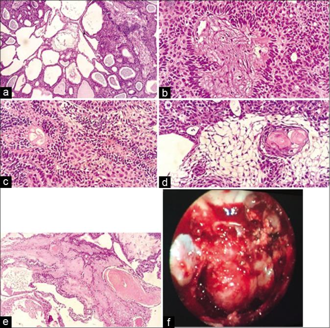 https://cdn.ncbi.nlm.nih.gov/pmc/blobs/fe53/7451162/24a1cd89f57b/SNI-11-228-g002.jpg