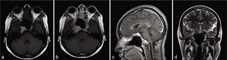 https://cdn.ncbi.nlm.nih.gov/pmc/blobs/fe53/7451162/a022e5c2534a/SNI-11-228-g003.jpg