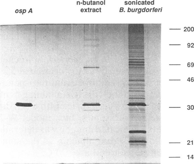 https://cdn.ncbi.nlm.nih.gov/pmc/blobs/fe5b/186137/fb1b16b2a0ad/iai00002-0204-a.jpg