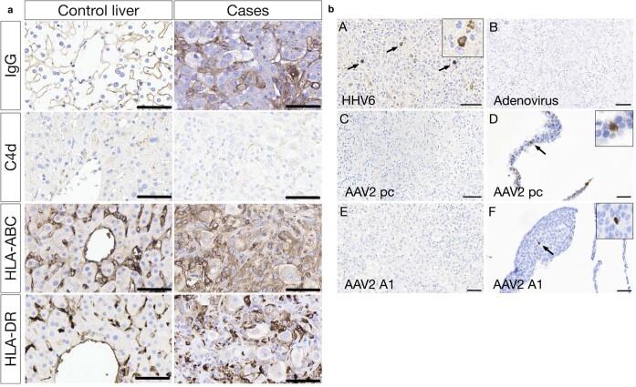 https://cdn.ncbi.nlm.nih.gov/pmc/blobs/fe5e/10191857/df8b693d6659/41586_2023_6003_Fig10_ESM.jpg