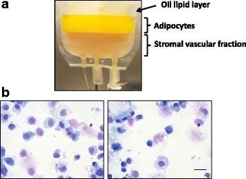 https://cdn.ncbi.nlm.nih.gov/pmc/blobs/fe61/5948766/937b84b07a53/13287_2018_886_Fig1_HTML.jpg