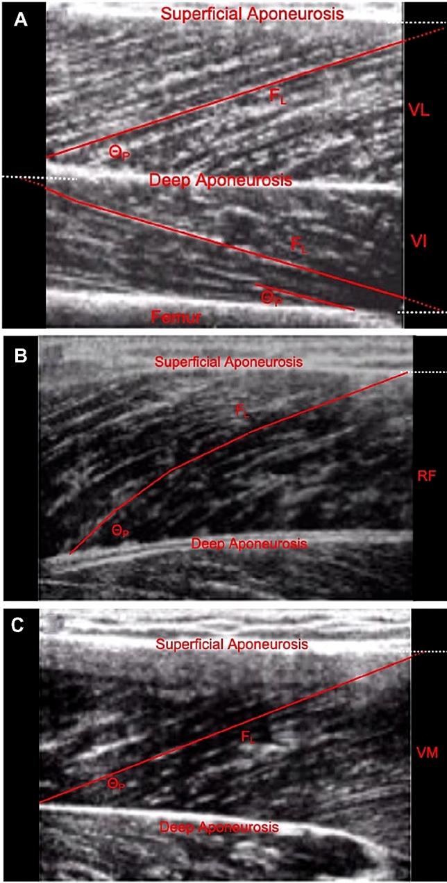https://cdn.ncbi.nlm.nih.gov/pmc/blobs/fe63/7966212/860b4dcc45bc/421_2020_4585_Fig1_HTML.jpg