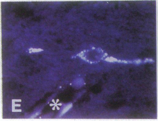 https://cdn.ncbi.nlm.nih.gov/pmc/blobs/fe6a/51690/e083325de812/pnas01060-0460-f.jpg