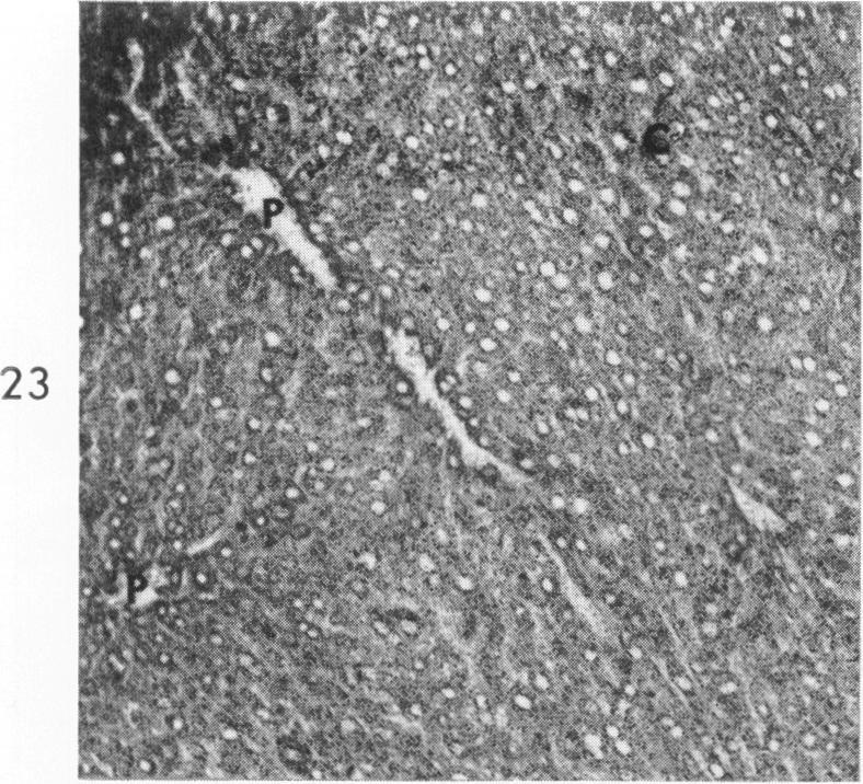 https://cdn.ncbi.nlm.nih.gov/pmc/blobs/fe71/1920425/ca5980af3454/amjpathol00285-0039-a.jpg
