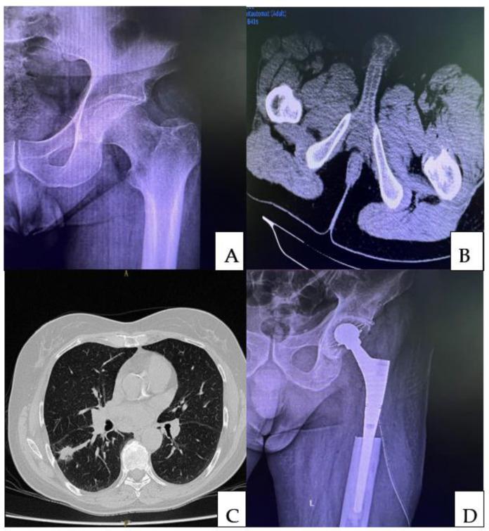 https://cdn.ncbi.nlm.nih.gov/pmc/blobs/fe75/9612355/9ec741bb36da/medicina-58-01463-g002.jpg